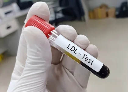 LDL-C test