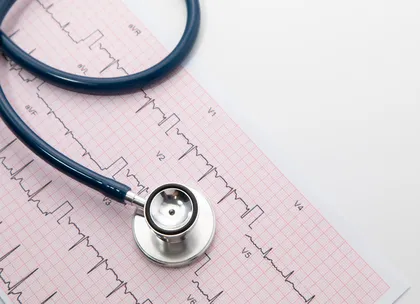 ECG