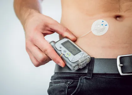 insulin pump