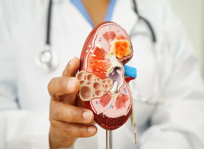 kidney disease