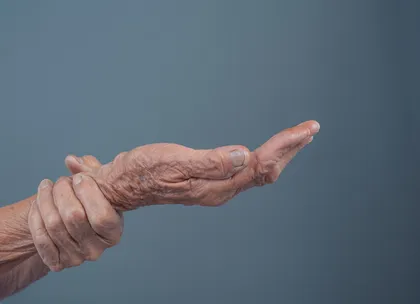 parkinson
