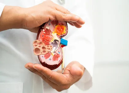 CKD