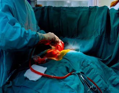 heart surgery 