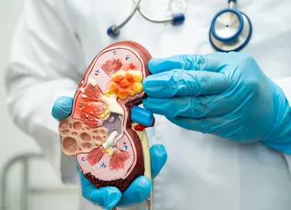 CKD