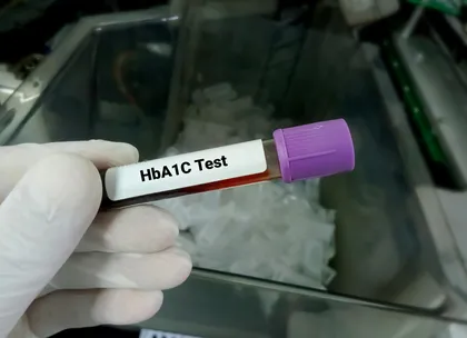 HbA1c test