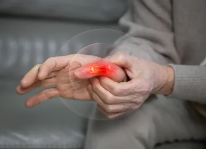 Rheumatoid arthritis