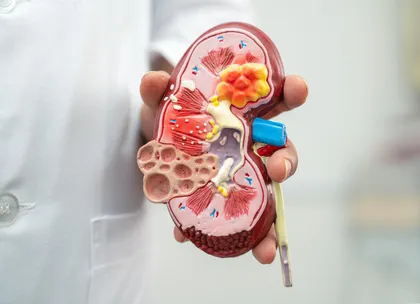 CKD