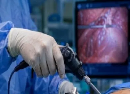 Catheter Ablation