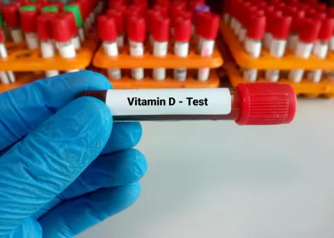 Vitamin D Deficiency Was Associated With Thyroid Markers in T2DM 