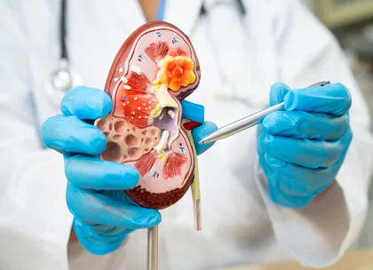 CKD