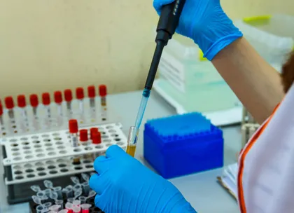 plasma analysis