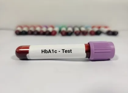 HbA1c test